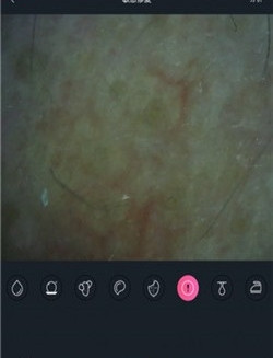 护肤AI检测手机安卓版截图1