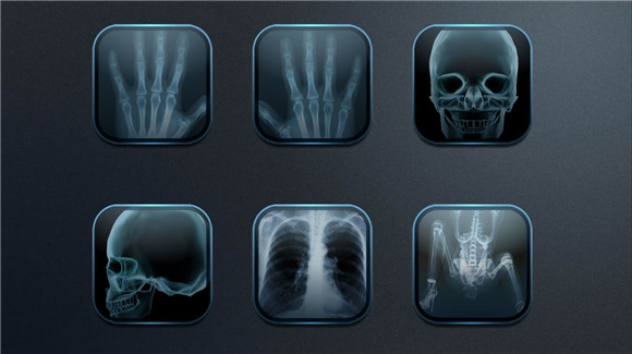 手机骨骼扫描软件官方最新版下载-骨骼扫描软件安卓版下载v1.0.1图1