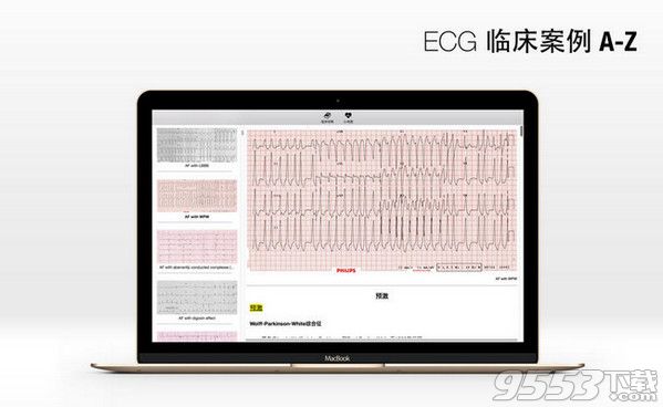 ECG A-Z Pro Mac版