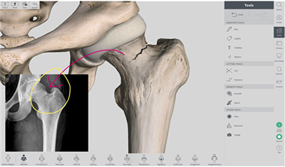 Complete Anatomy人体骨骼图3D高清截图2
