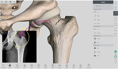 Complete Anatomy人體骨骼圖3D高清截圖2