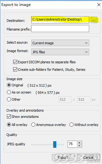 MicroDicom viewer(Dicom格式看图软件) v2.9.2最新版