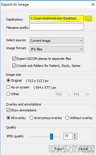 MicroDicom viewer(Dicom格式看圖軟件) v2.9.2最新版