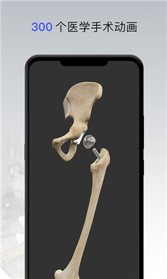 骨科专家app下载-骨科专家手机版下载v1.0.0图4