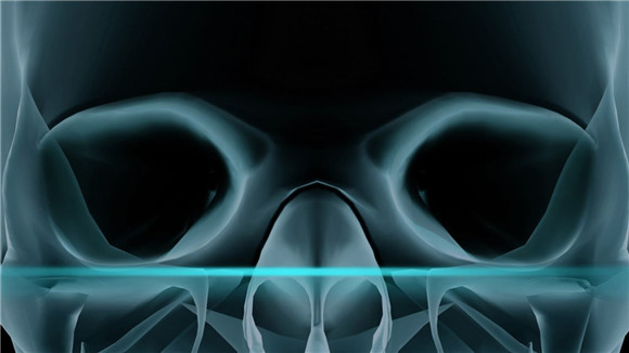 骨骼扫描软件安卓版截图2