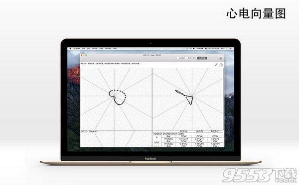 心电图案例库Pro Mac中文版