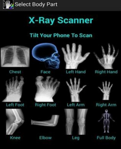 手机x光透视身体app下载-x光透视骨骼软件下载v1.6图3