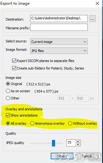 MicroDicom viewer(Dicom格式看图软件) v2.9.2最新版